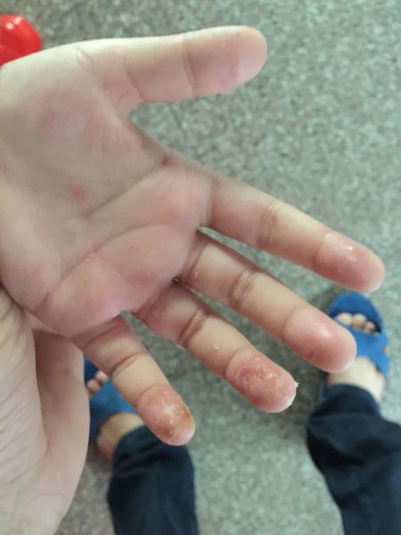 赞美女孩手指漂亮的句子_(形容手指好看的句子)