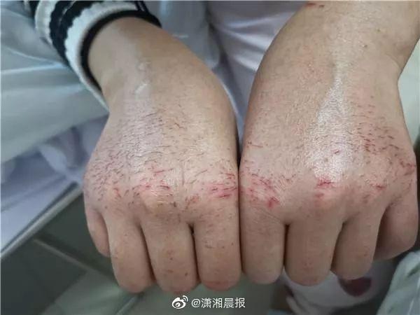武汉抗疫的句子 武汉抗疫的句子